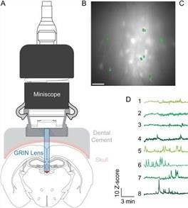 Miniscope电子对焦成像系统--eTFMS3