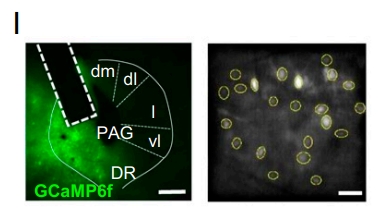 动物钙成像研究引领生物医学发展